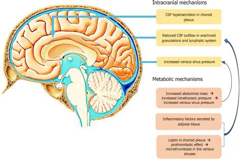 Understanding Glioma and Intracranial Pressure