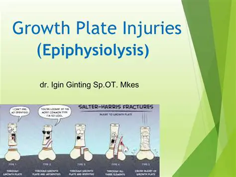Understanding Growth Plate Injuries