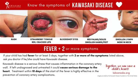 Understanding Kawasaki Disease