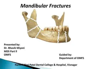 Understanding Mandibular Fractures and Malocclusion