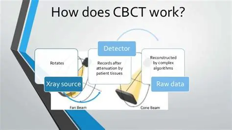 Understanding of CBCT Hardware