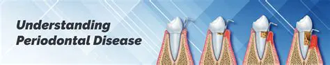 Understanding Periodontal Disease and its Causes