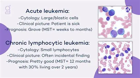 Understanding the Complexity of Acute Leukemia