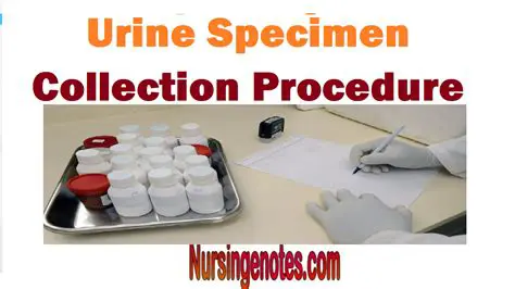 Understanding the Importance of Proper Urine Specimen Collection