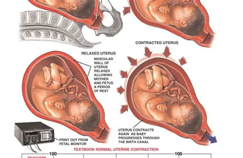 Uterine Contraction During Labor